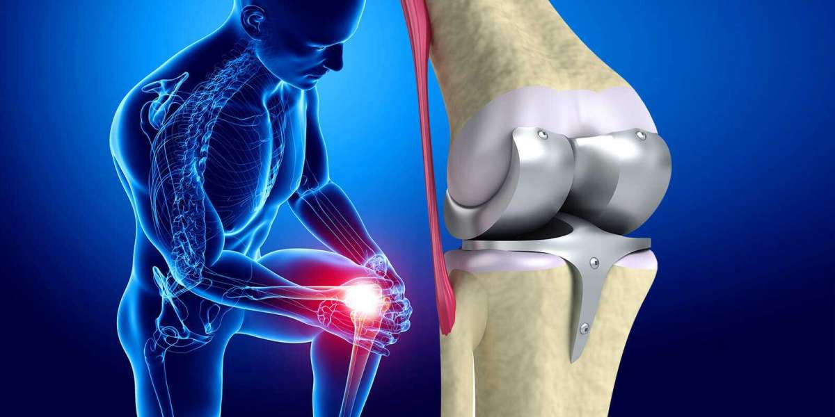 Increasing Healthcare Expenditure to Trigger Growth in Knee Replacement Market Share