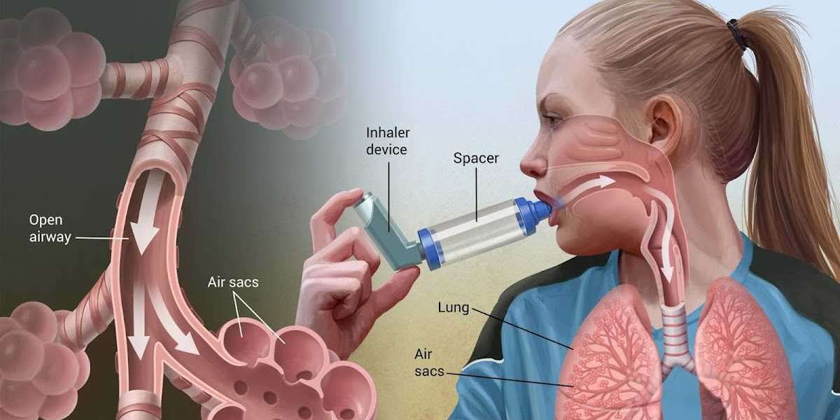 Global Asthma Inhaler Device Market Share To Expand At A Notable CAGR Of 6.42%