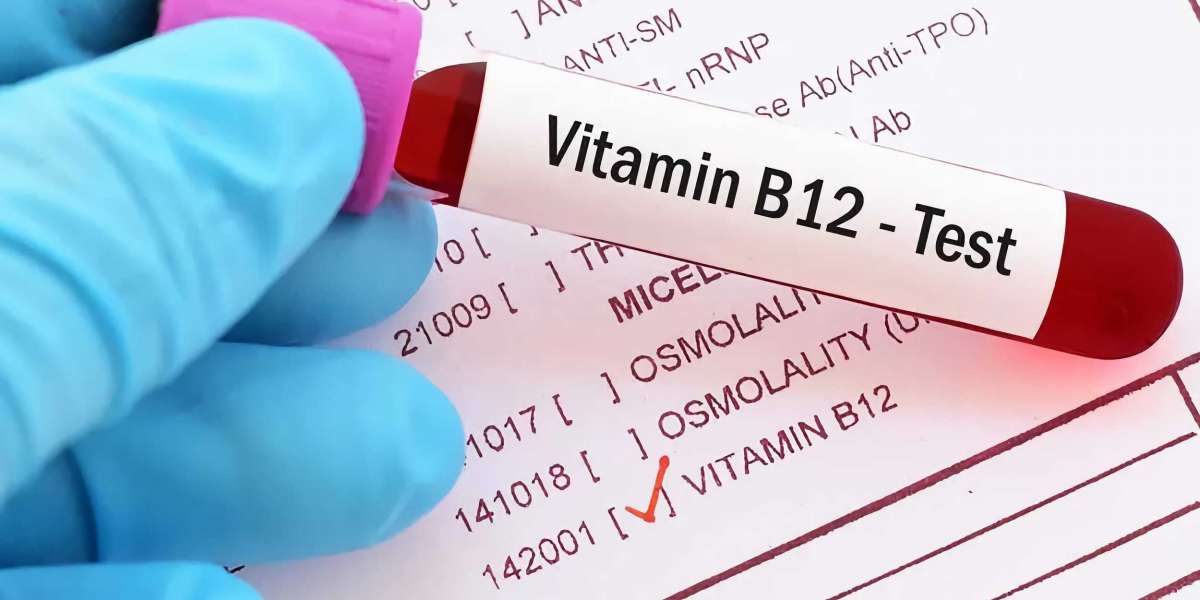 Americas to Spearhead Active B12 Test Market Share