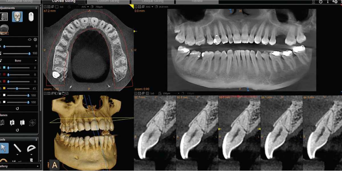 CBCT Dental Imaging Market Share of Top Key Players with Tactics for Industry Growth