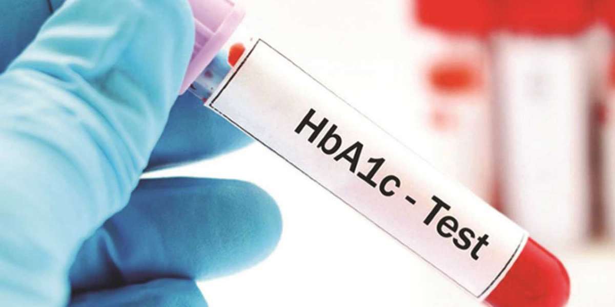 Increased Product Introductions by Leading Players to Promote HbA1c Testing Market Share Growth