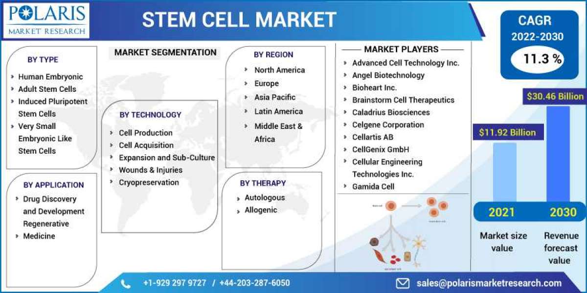 Stem Cell Market Size, Share, Growing Demand, Top Trends And Drivers For 2023-2032
