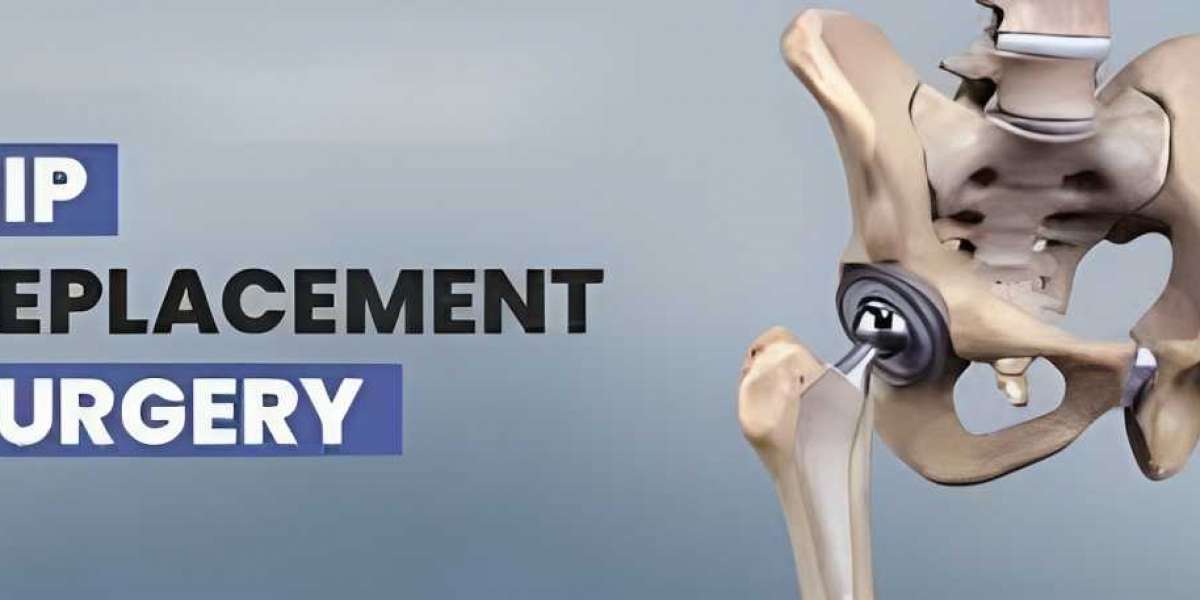 Choose Yapita Health for knee replacement surgery in Turkey