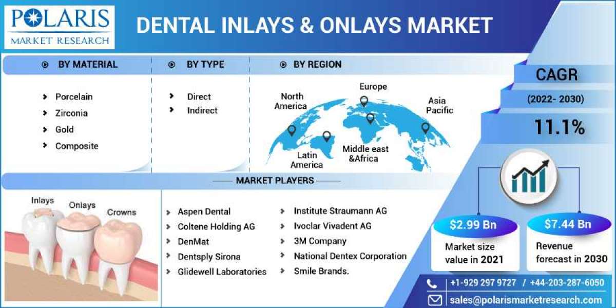 Dental Inlays & Onlays Market Size, Share, Growing Demand, Top Trends And Drivers For 2023-2032