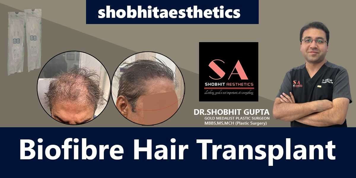 Embrace Renewed Confidence with Biofibrе Hair Transplant