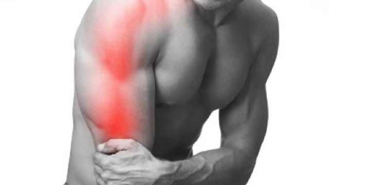 How to Treat Cervical Radiculopathy Pain