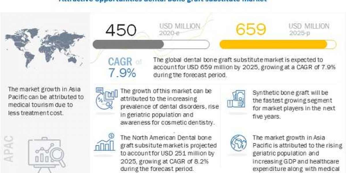 Dental Bone Graft Substitute Market Leading Players, Growth Rate, Cost and Future Outlook to 2025