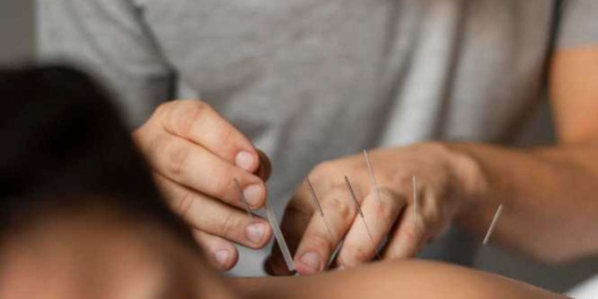 Practical Benefits Of Acupuncture For Pain in Morristown