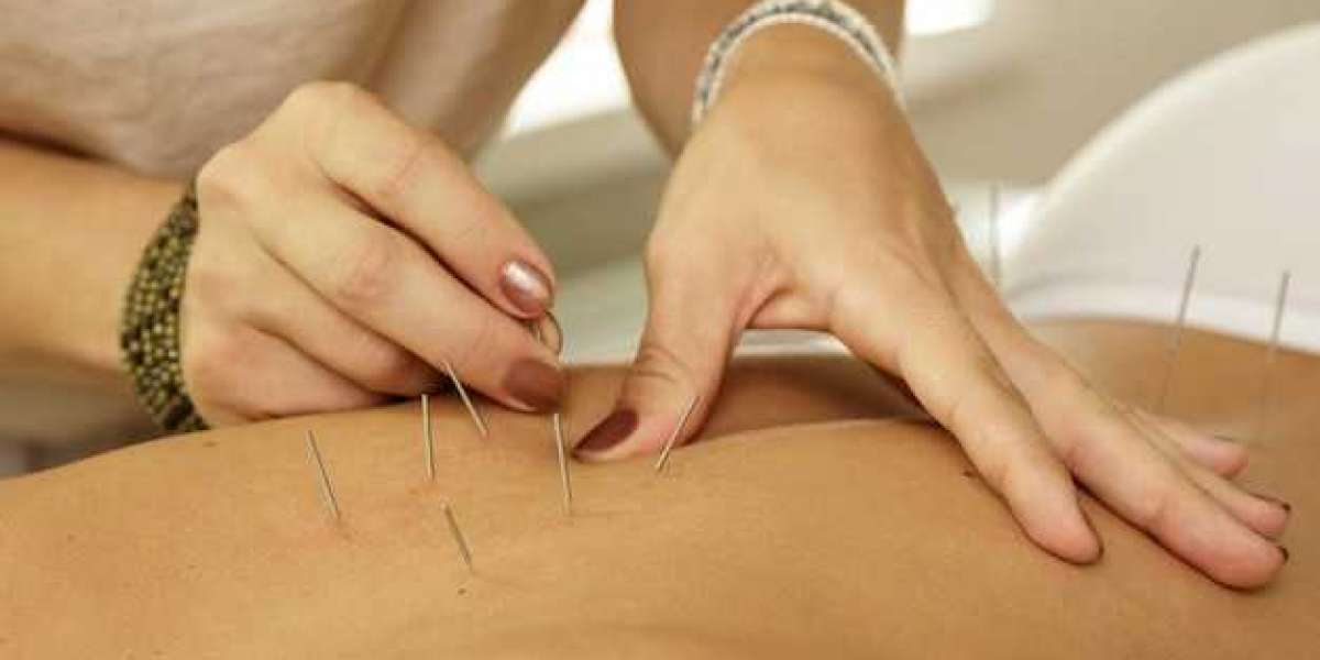 Unveiling The Healing Touch CM Harmony Acupuncture Rescues Morristown Residents From Low Back Pain And Headaches