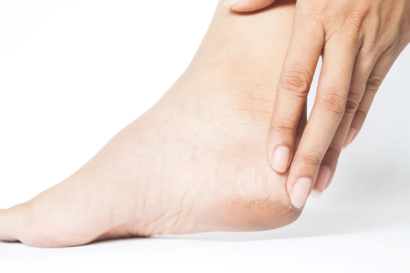 Preliminary Signs of a Foot Infection and What to Do About It