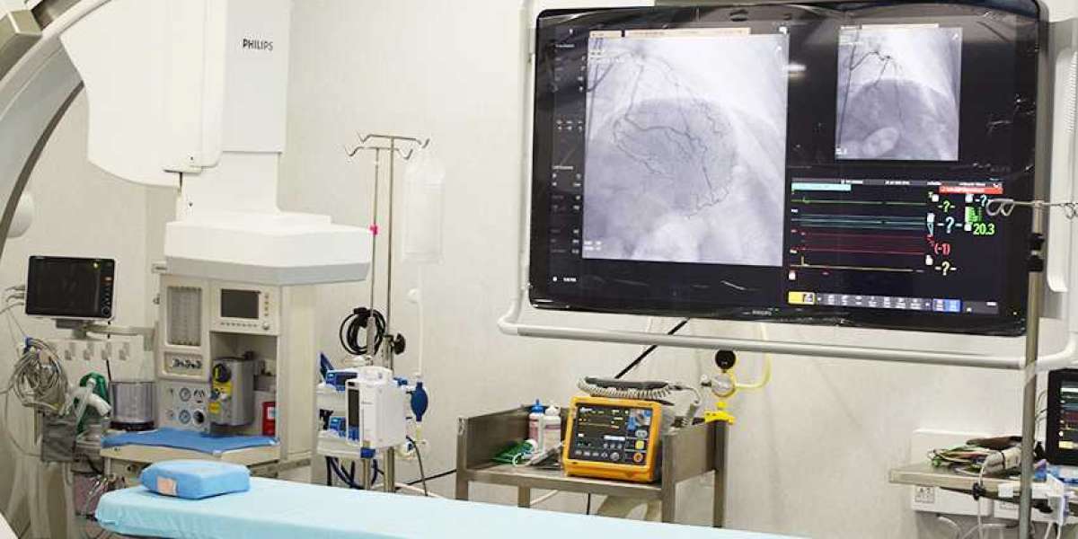 Choosing the Best Hospital for an Angiogram in Chennai: Factors to Consider