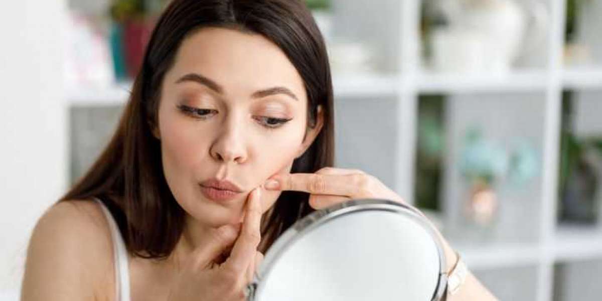 Understanding Pimples and Acne: Effective Treatment Strategies