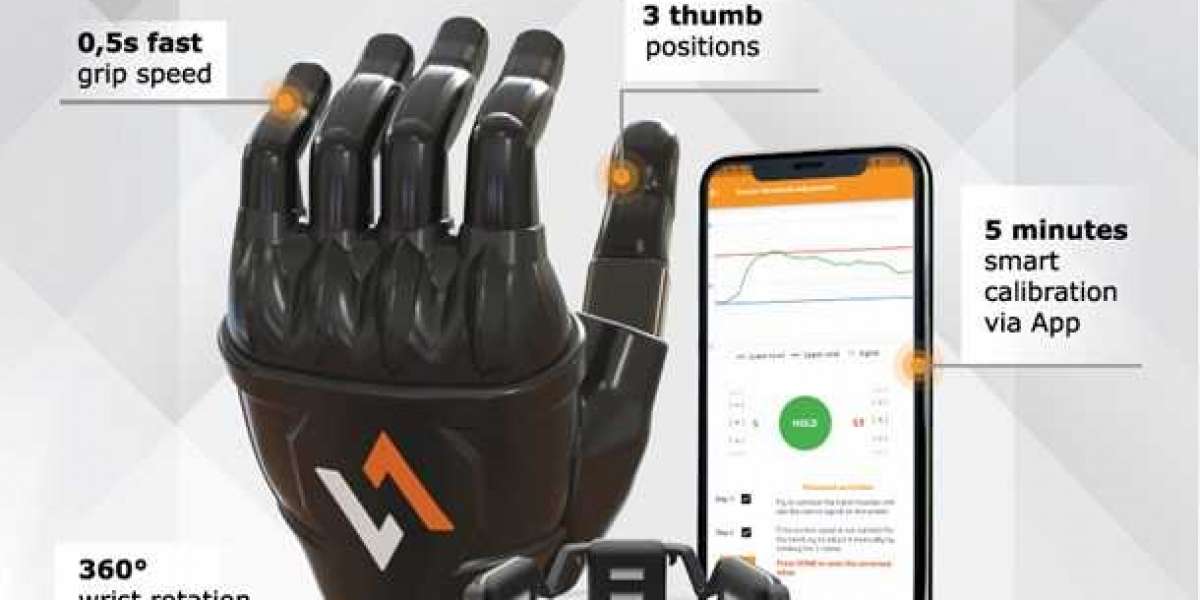 Unveiling the Marvel: The Myoelectric Hand Revolution