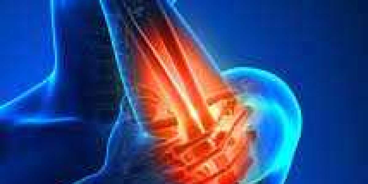 The Ultimate Guide to Alleviating Tennis Elbow Pain