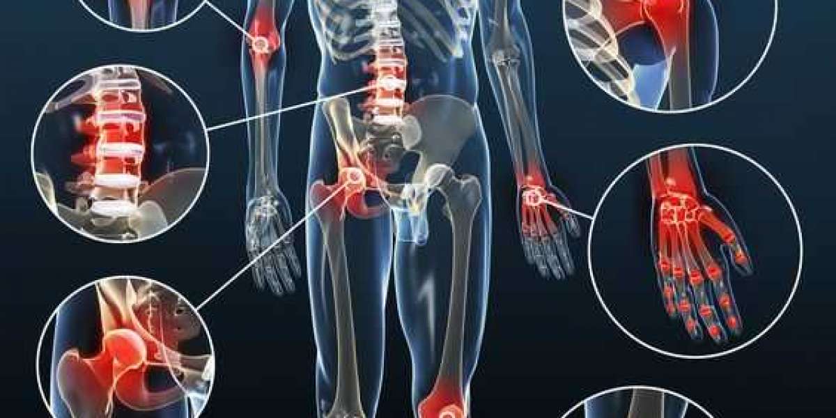 Unlocking Relief: 9 Sciatica Stretches for Nerve Pain Alleviation