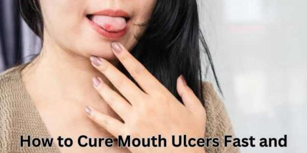 How to Heal Mouth Ulcers Naturally and Fast