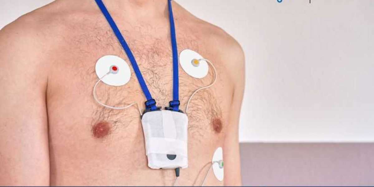 Holter ECG Market Size, Share, Price, Trends, Outlook, Growth, Analysis, Report and Forecast 2024-2032