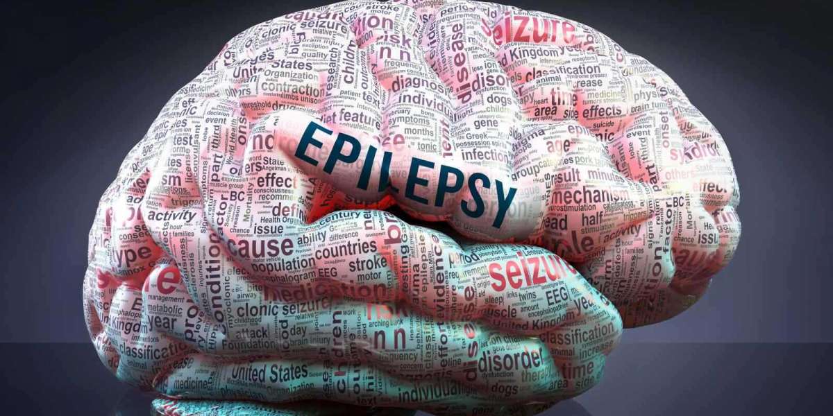 The Epilepsy Chronicles: Tales of Fortitude and Adaptability
