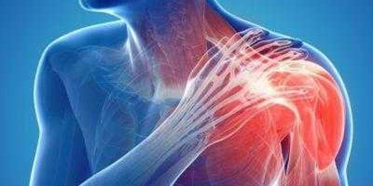 12 Essential Steps to Manage Sore Muscles and Joint Pain