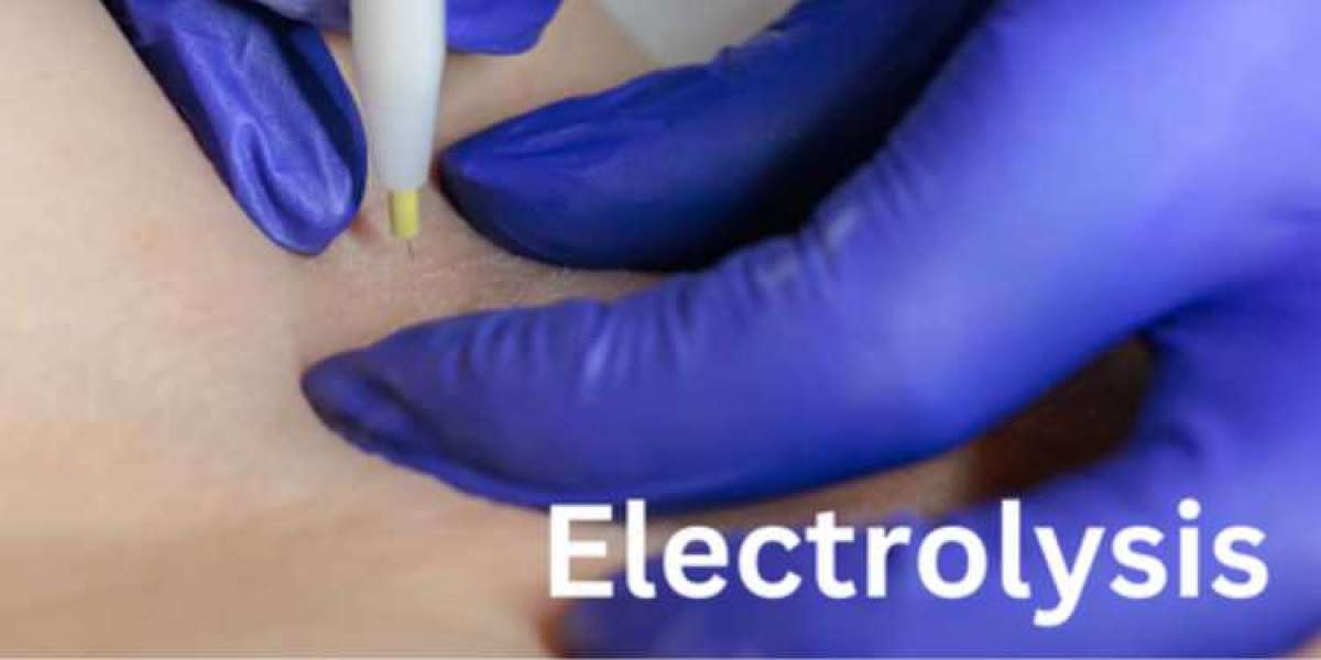 Electrolysis for Permanent Hair Removal