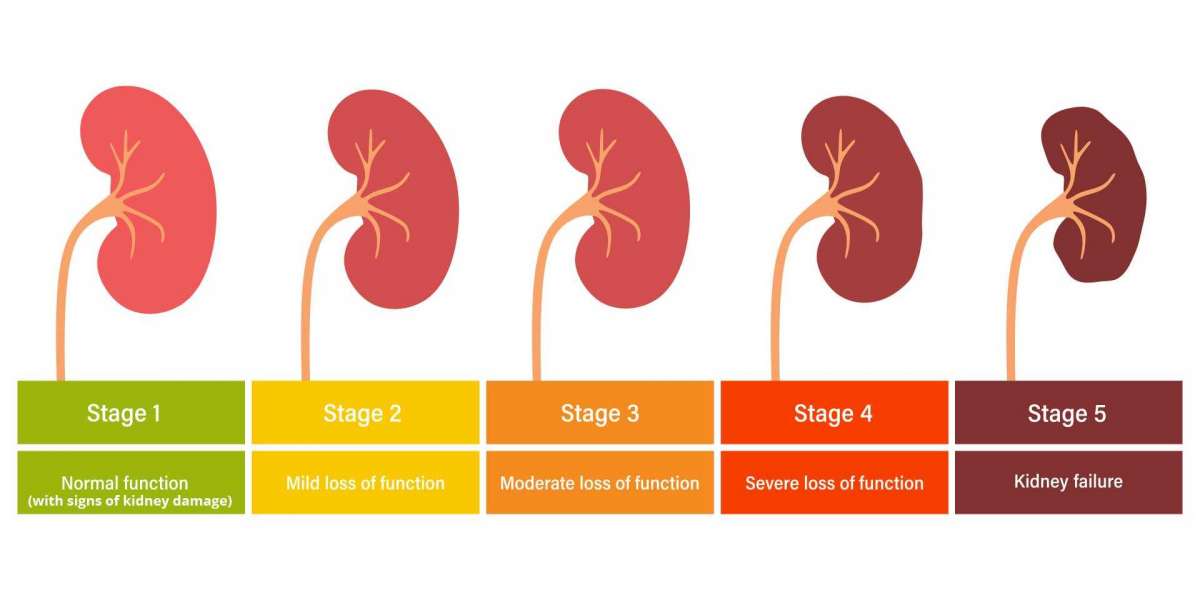 Navigating Chronic Kidney Disease: A Patient's Guide to Early Diagnosis and Hope
