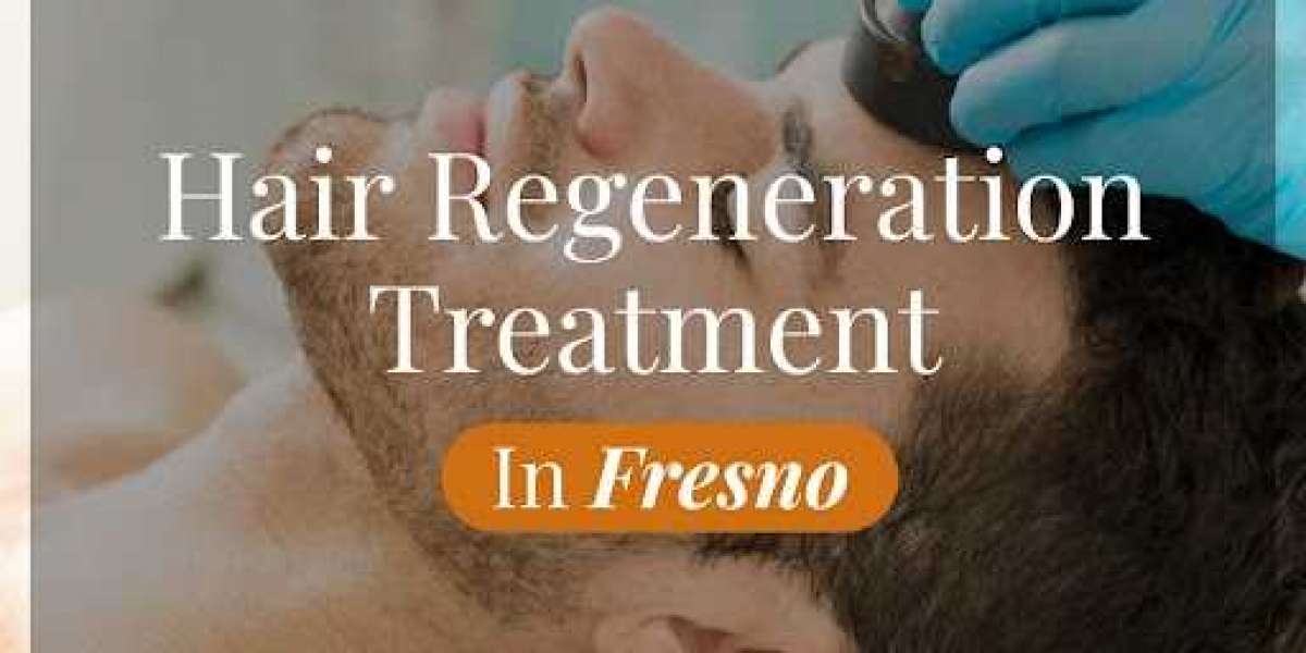 Demystifying Hair Regeneration Treatment: Facts and Myths in Fresno 2024