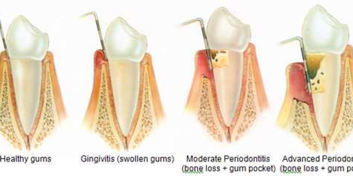 Periodontology & Periodontol Diseases in UK
