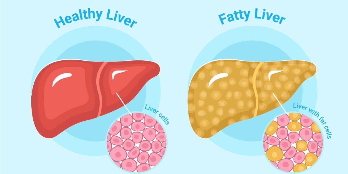 Tips for Maintaining a Healthy Liver: Your Guide to Liver Wellness