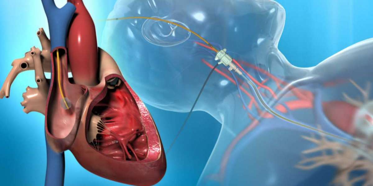 Beyond Diagnosis: Therapeutic Applications of Cardiac Catheterization