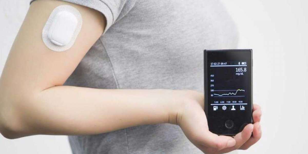 Continuous Glucose Monitoring Market Share: A Shifting Landscape (2024 Update)