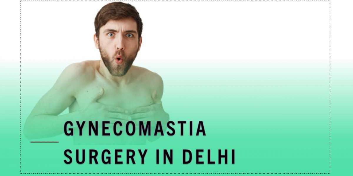 Gynecomastia Surgery with Dr. Vivek Kumar in Delhi